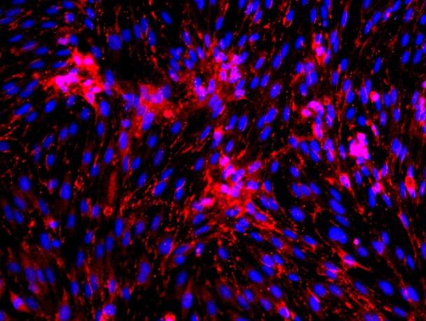 大鼠腦微血管內(nèi)皮細胞,Rat brain microvascular endothelial cells