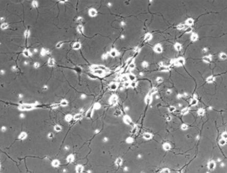 大鼠小脑颗粒细胞,Granular cells of rat cerebellum