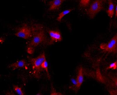 大鼠视网膜Muller细胞,Muller cells of rat retina