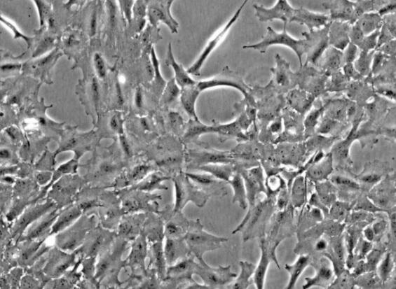 大鼠晶状体上皮细胞,Rat Lens Epithelial Cells