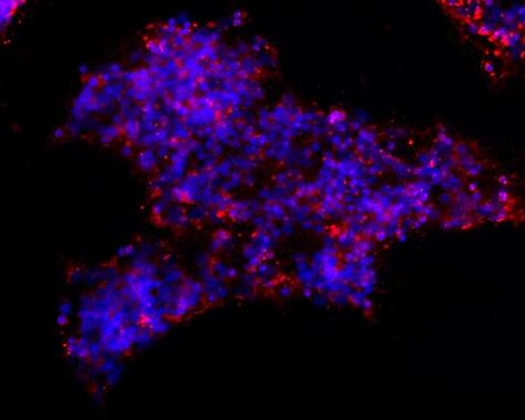 大鼠视网膜神经节细胞,Retinal ganglion cells of rats
