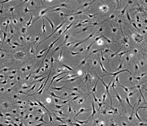 大鼠角膜成纤维细胞,Rat corneal fibroblasts