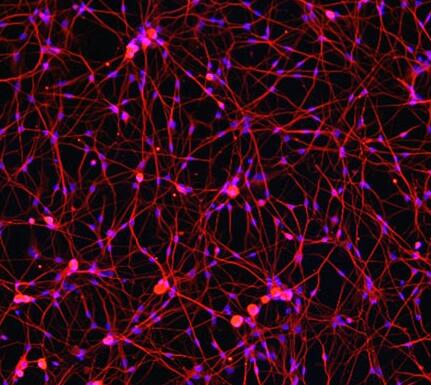 大鼠背根神经元细胞,Rat dorsal root neurons