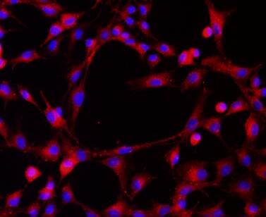 大鼠骨髓来源内皮祖细胞,Rat bone marrow derived endothelial progenitor cells