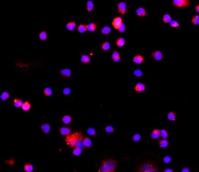 大鼠肝枯否细胞,Kupffer cells of rat liver