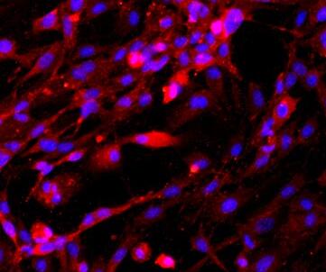 大鼠海绵体内皮细胞,Rat cavernous endothelial cells