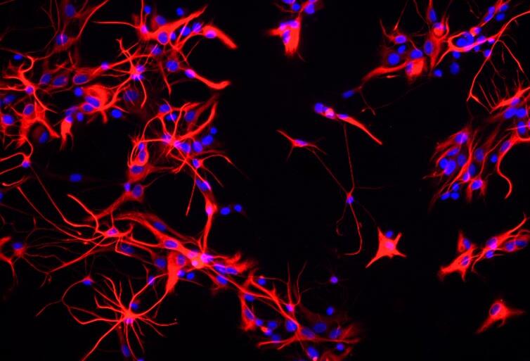 大鼠神经星形胶质细胞,Rat heart microvascular endothelial cells