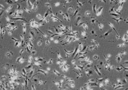 大鼠骨髓来源巨噬细胞,Rat bone marrow derived macrophages