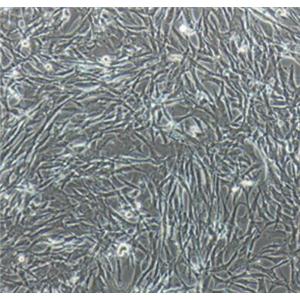 大鼠脑动脉血管平滑肌细胞,Smooth muscle cells of cerebral artery in rats