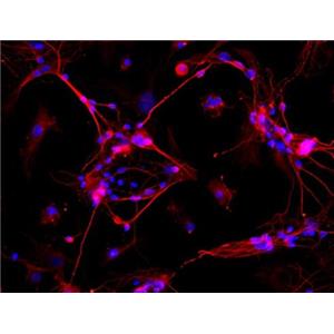 大鼠海马神经元细胞,Hippocampal neurons in rats