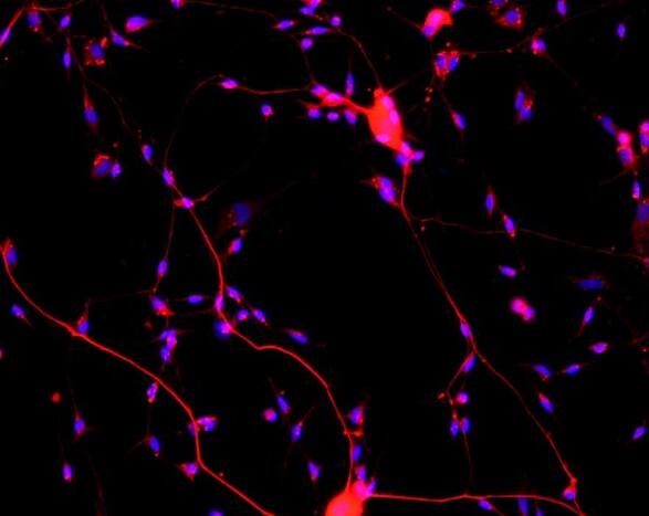 大鼠脊髓神经元细胞,Spinal cord neurons in rats