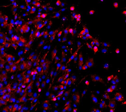 大鼠椎间盘髓核细胞,Nucleus pulposus cells of rat intervertebral disc