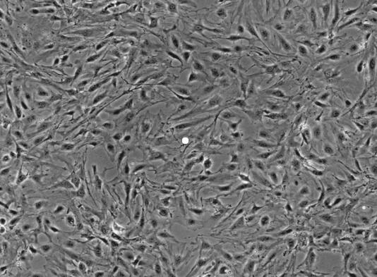 大鼠视乳头星形胶质细胞,Astrocytes in rat optic papilla