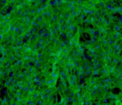 大鼠前列腺平滑肌细胞,Smooth muscle cells of rat prostate