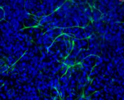 大鼠肝外膽管上皮細(xì)胞,Epithelial cells of extrahepatic bile duct in rats