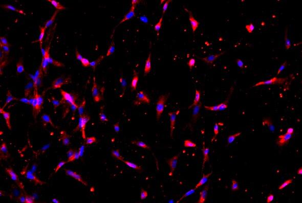 大鼠睪丸支持細(xì)胞,Sertoli cells of rat testis