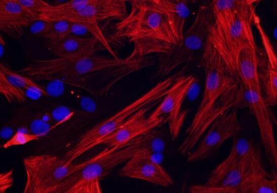 大鼠骨髓树突状细胞(成熟DC细胞),Rat bone marrow dendritic cells (mature DC cells)