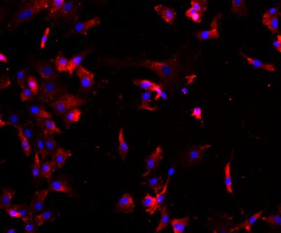 大鼠骺软骨细胞,Rat epiphyseal chondrocytes