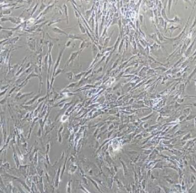 大鼠脉络膜微血管内皮细胞,Rat choroidal microvascular endothelial cells