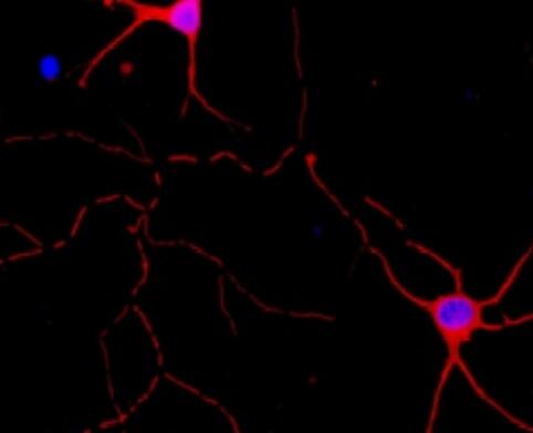 大鼠视网膜前体细胞,Rat retinal precursor cells