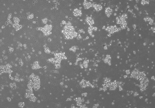 大鼠外周血树突状细胞(成熟DC细胞),Rat peripheral blood dendritic cells (mature DC cells)