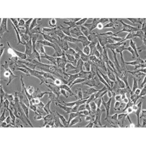 大鼠骨内膜间充质干细胞