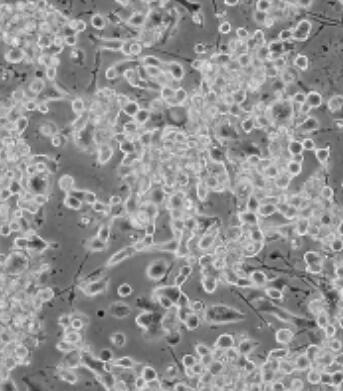 大鼠心脏纤维原细胞,Rat cardiac fibroblasts