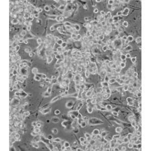 大鼠心脏纤维原细胞,Rat cardiac fibroblasts