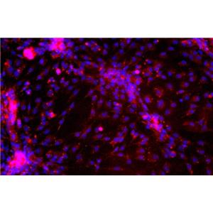 大鼠真皮微血管內(nèi)皮細(xì)胞,Dermal microvascular endothelial cells of rats