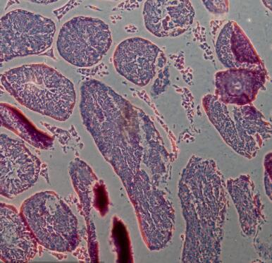 大鼠睪丸間質(zhì)細(xì)胞,Leydig cells of rat testis