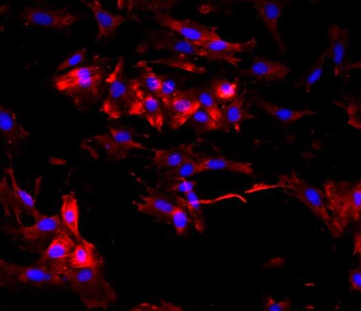 大鼠胃平滑肌细胞,Smooth muscle cells of rat stomach