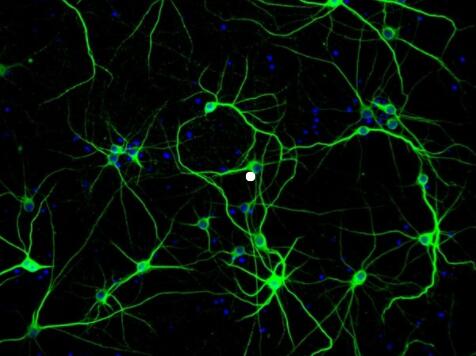 大鼠肠神经嵴干细胞,Rat intestinal neural crest stem cells