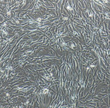 大鼠主动脉外膜成纤维细胞,Rat aortic adventitia fibroblasts