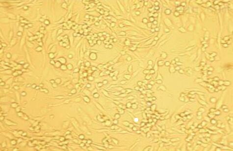 大鼠脐静脉内皮细胞,Rat umbilical vein endothelial cells