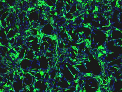 大鼠三叉神经星形胶质细胞,Rat trigeminal astrocytes
