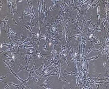 兔肺大動脈平滑肌細(xì)胞,Rabbit pulmonary artery smooth muscle cells