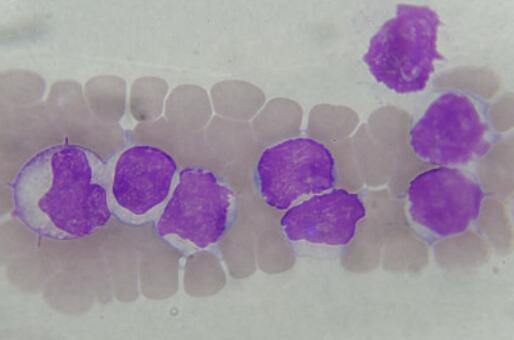 兔骨髓单核细胞,Rabbit bone marrow monocytes