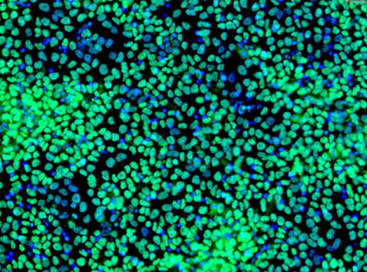 兔肌源性干细胞,Rabbit muscle derived stem cells