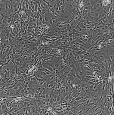 兔主动脉内皮细胞,Rabbit aortic endothelial cells