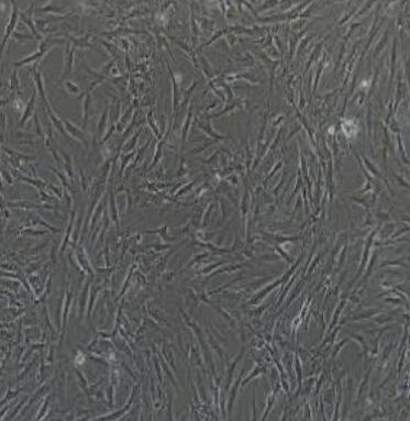 兔脐静脉内皮细胞,Rabbit umbilical vein endothelial cells