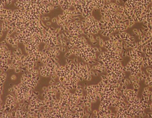 兔外周血巨噬细胞,Rabbit peripheral blood macrophages