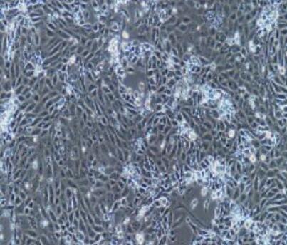 兔羊膜间质细胞,Rabbit amniotic mesenchymal cells