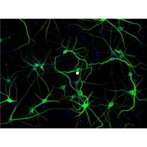 大鼠肠神经嵴干细胞,Rat intestinal neural crest stem cells