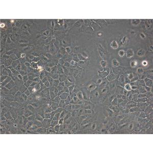 大鼠胚胎肝母细胞