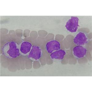 兔骨髓单核细胞,Rabbit bone marrow monocytes