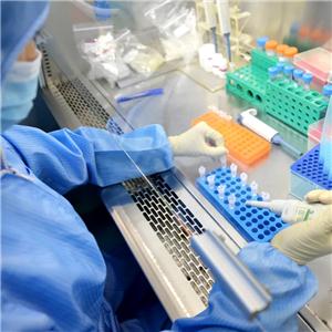 Duck Tembusu Virus Probe qRT-PCR Kit