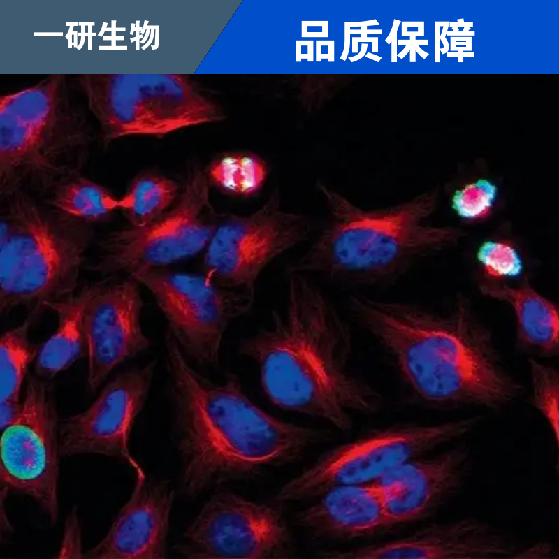 人结直肠癌肺转移细胞,T84