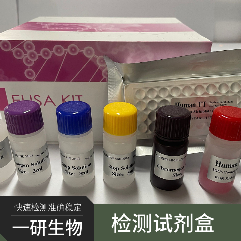 λ-IgLC检测试剂盒,Human lambda immunoglobulin light chain, λ-IgLC Elisa Kit
