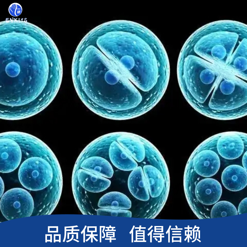 人子宫内膜低分化腺癌细胞,EAG3