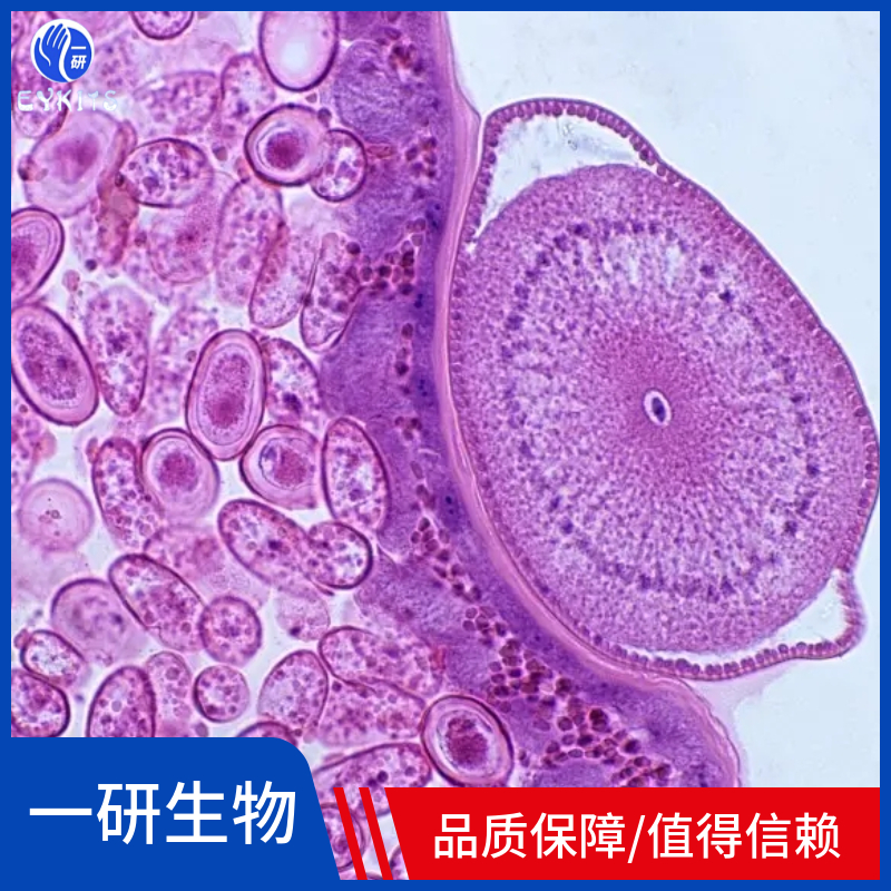 EB病毒转化的人B淋巴细胞（傣族）,KM9405
